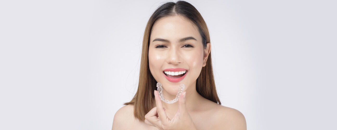 How Can Clear Aligners Correct an Overbite?